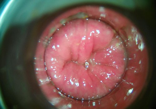 Dr. Jorge Ojeda Ortiz Cirugía Oncológica y Ginecológica en Pachuca, Hidalgo Experto en Detección y Tratamiento de Cáncer Mamario y Cervicouterino