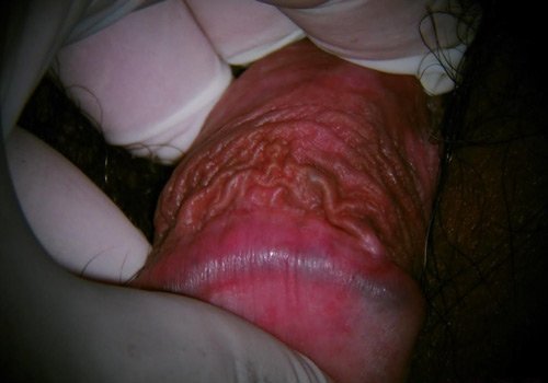 Dr. Jorge Ojeda Ortiz Cirugía Oncológica y Ginecológica en Pachuca, Hidalgo Experto en Detección y Tratamiento de Cáncer Mamario y Cervicouterino