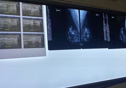 Dr. Jorge Ojeda Ortiz Cirugía Oncológica y Ginecológica en Pachuca, Hidalgo Experto en Detección y Tratamiento de Cáncer Mamario y Cervicouterino